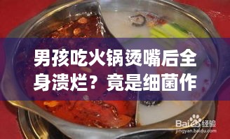 男孩吃火锅烫嘴后全身溃烂？竟是细菌作祟还传染！ - 游戏玩家必知